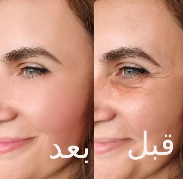 Priyanka Tone  للتجاعيد وشد الوجة  متجر