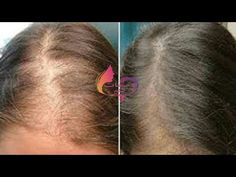 إصلاح الشعر التالف