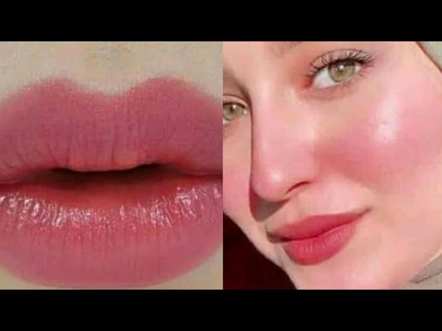 عرض 3 قطع -مورد خدود وشفايف 