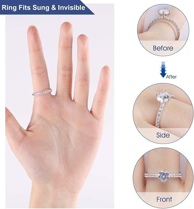 Ring resizer