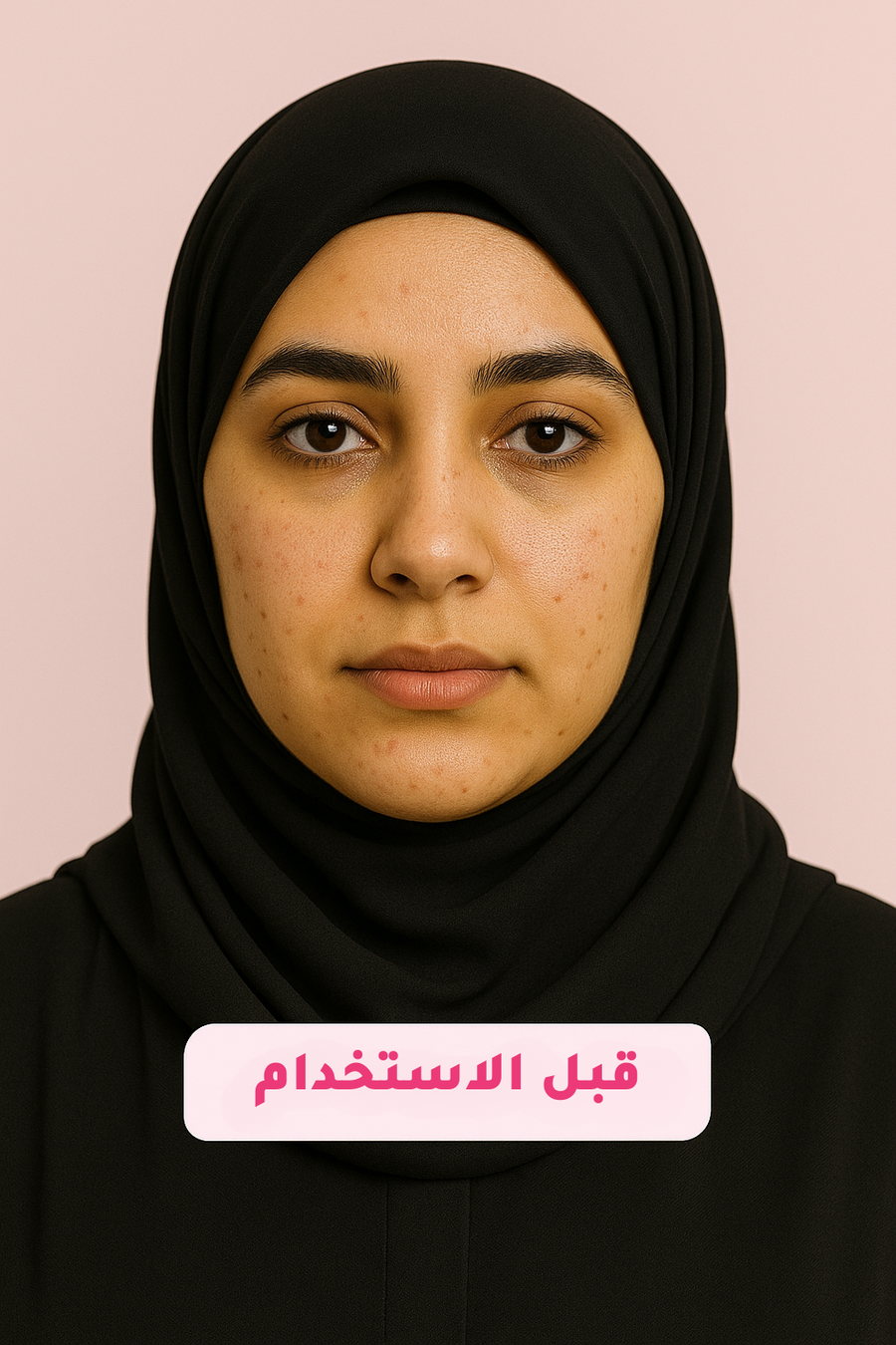 قبل الاستخدام