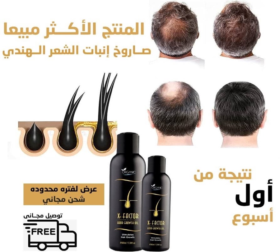 يزيد كثافة وسمك البصيلة