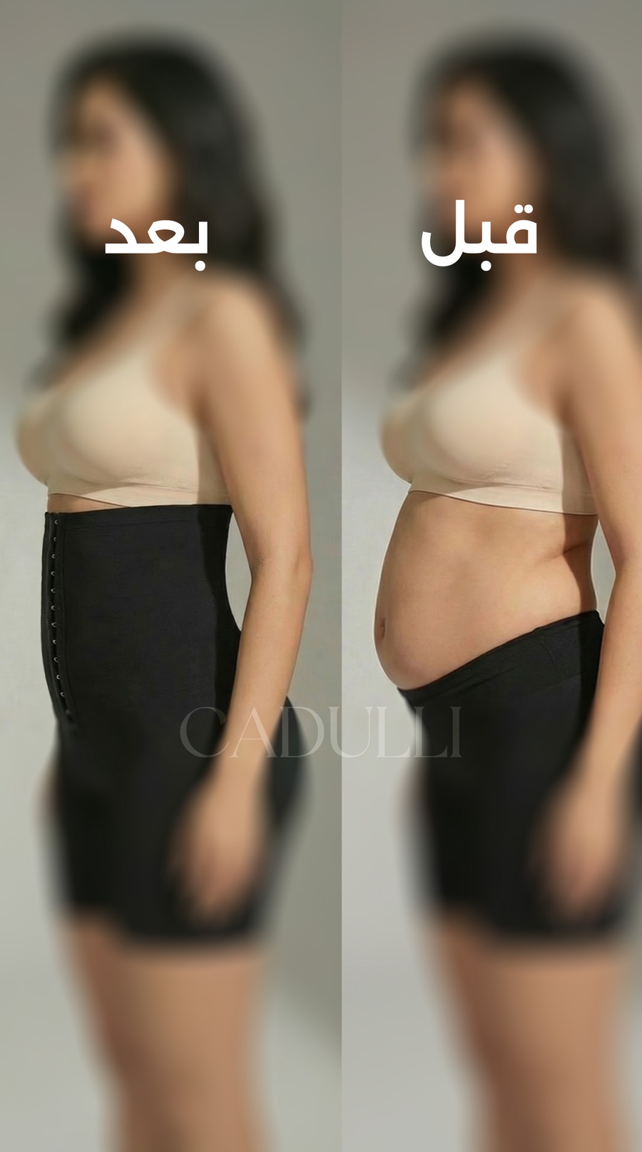 تغير كبير (Before & After)