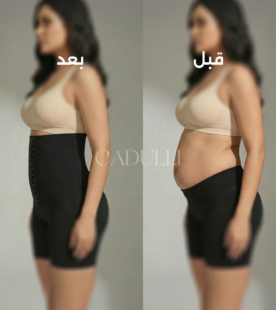 تغير كبير (Before & After)