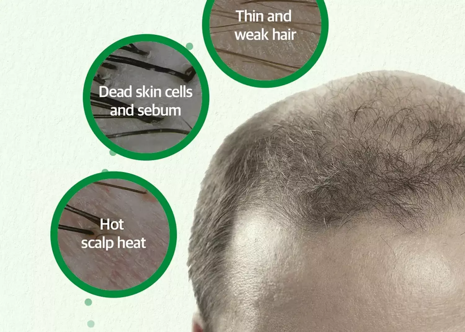 SOME BY MI - Cica Peptide Anti Hair Loss Derma Scalp Tonic