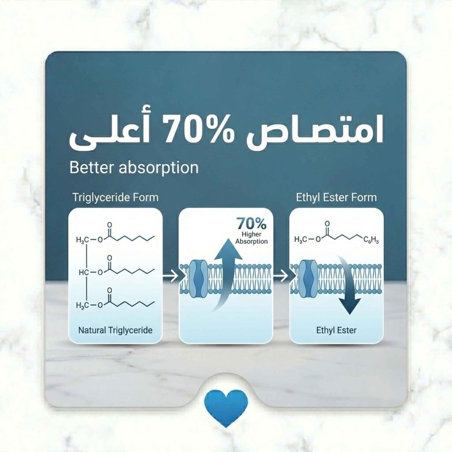 التركيبة مختلفة تماما هنا