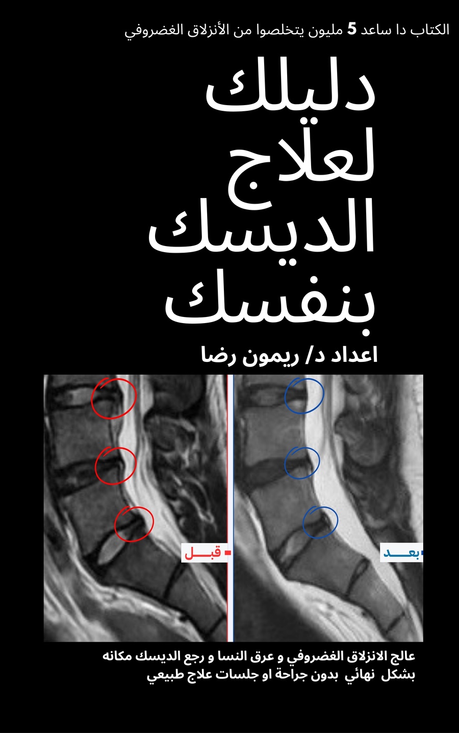 بيتر - القاهره