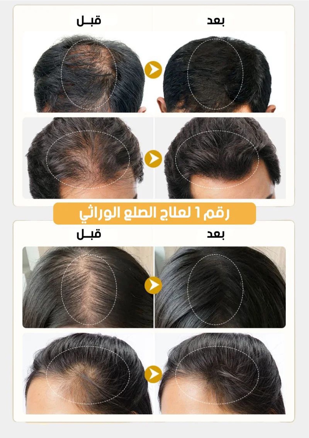 نتائج مبهره ل 80% من العملاء