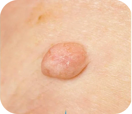 شكلها غير مستحب في الصور والمناسبات.