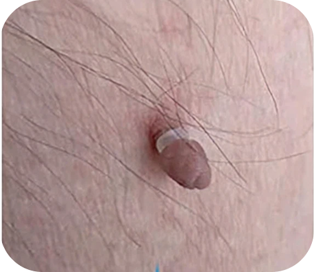 شكلها غير مستحب في الصور والمناسبات.