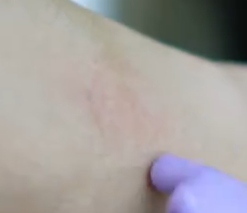 النتيجة الطبيعية