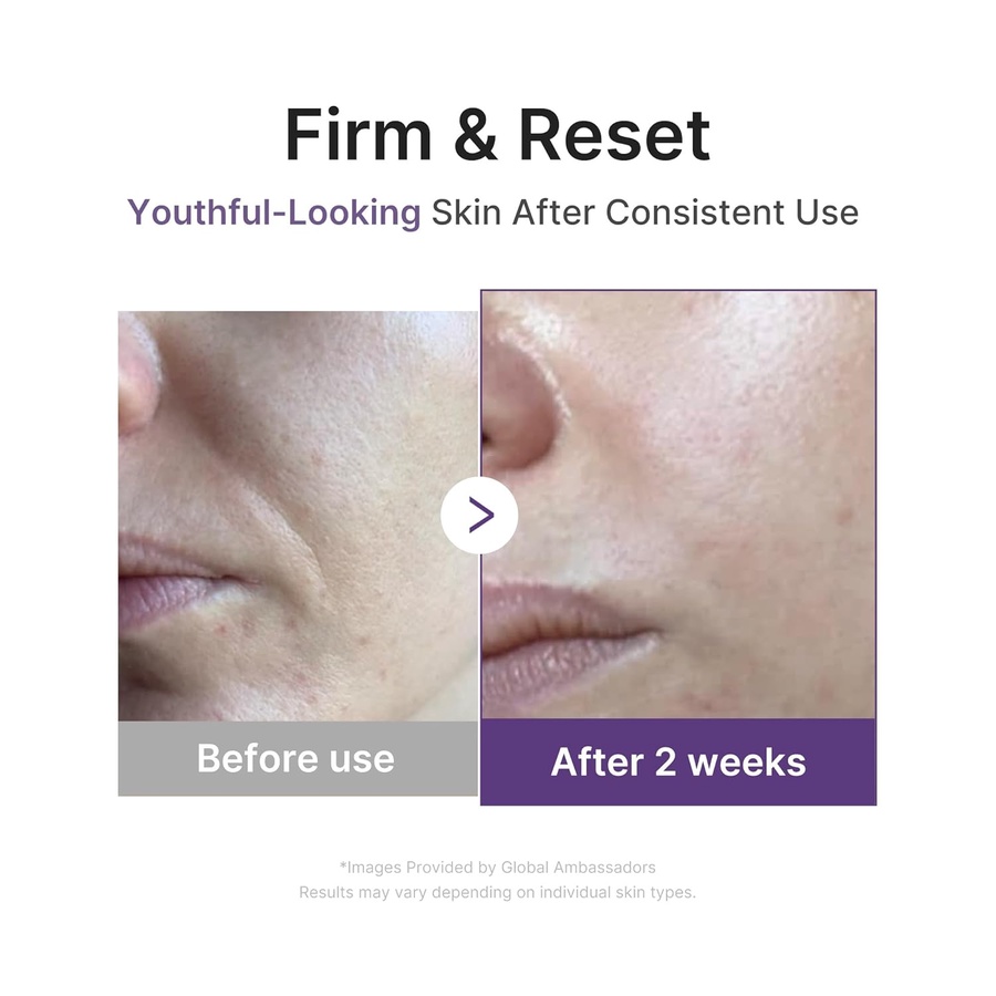 MEDICUBE Retinol Nmn Boosting Serum 30ml