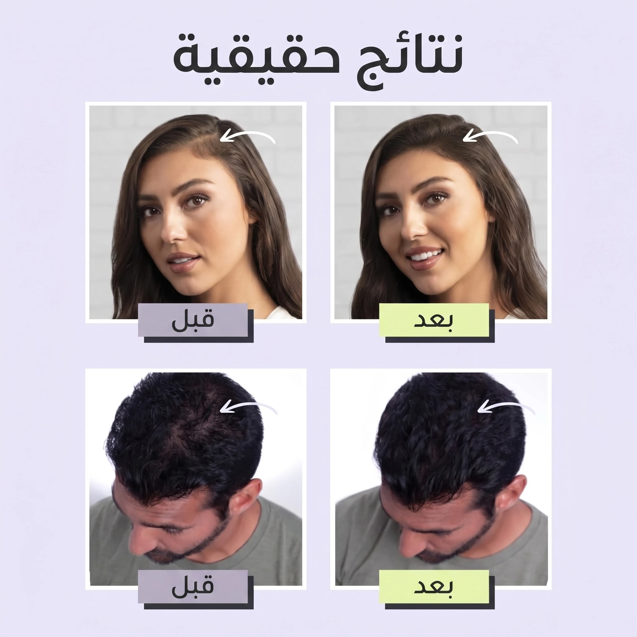 ألياف تكثيف الشعر Toppik