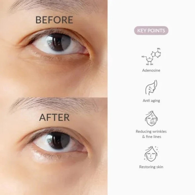 Dr. Althea - Retinol Flat Iron Eye Roller 25ml
