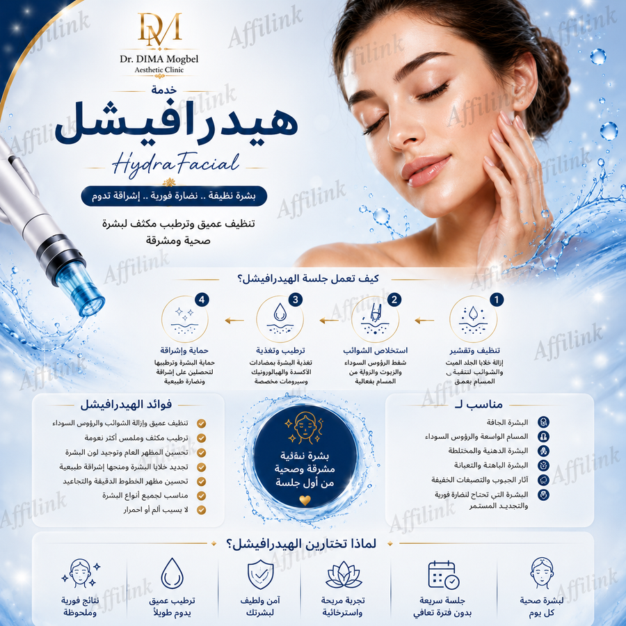 خدمة هيدرافيشل
