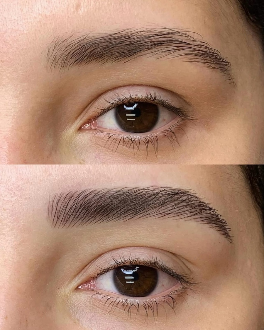 مايكروبليدنج (Microblading)