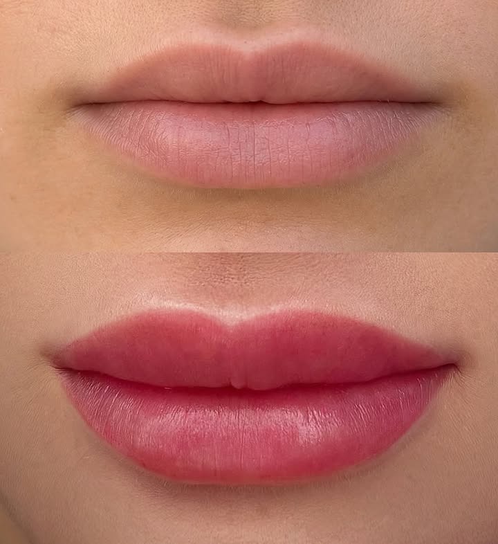 باقة الشفاه المثالية 💋 (Perfect Lips Package)