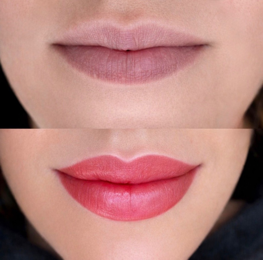 باقة الشفاه المثالية 💋 (Perfect Lips Package)