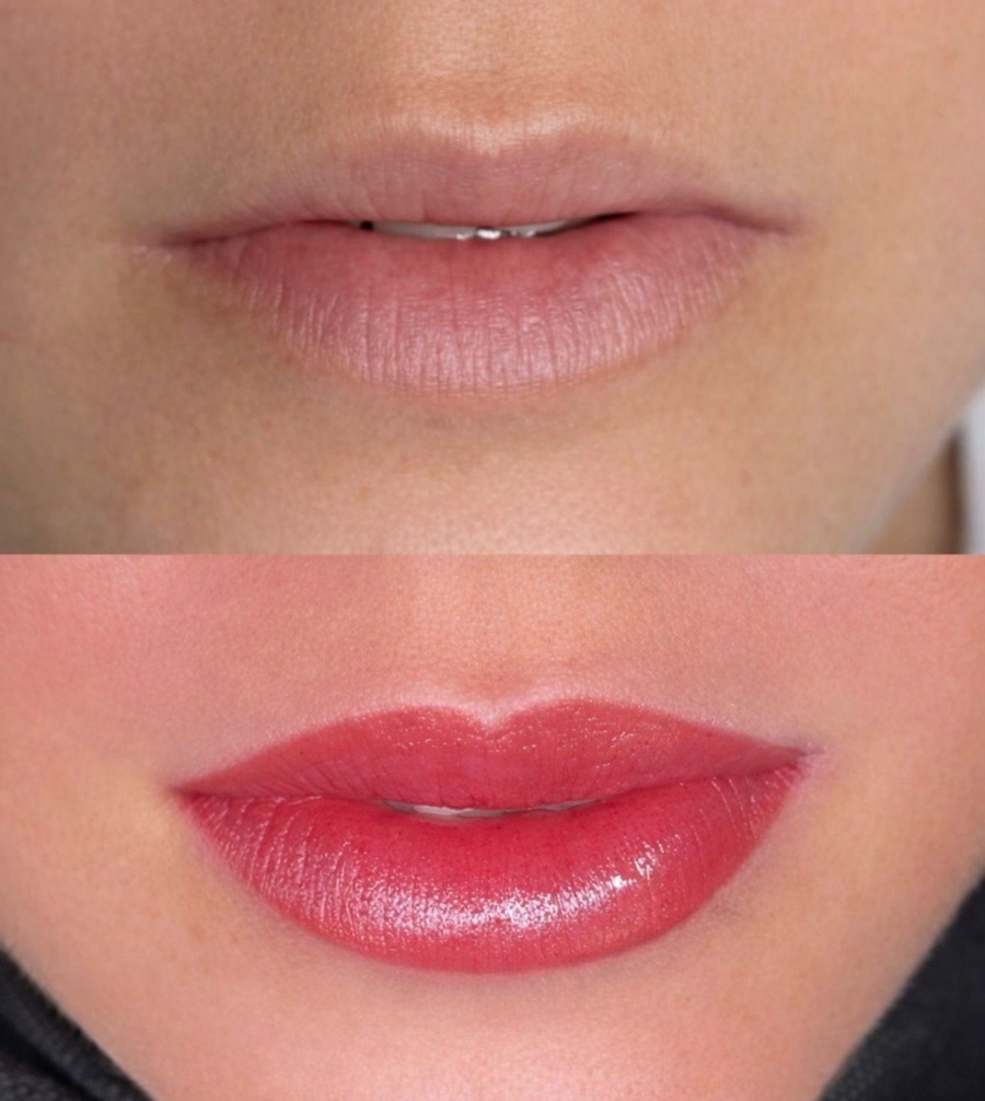 باقة الشفاه المثالية 💋 (Perfect Lips Package)