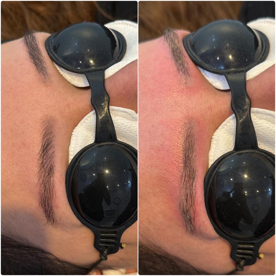 استعادة الحواجب الطبيعية ✨ (Natural Eyebrow Restoration)