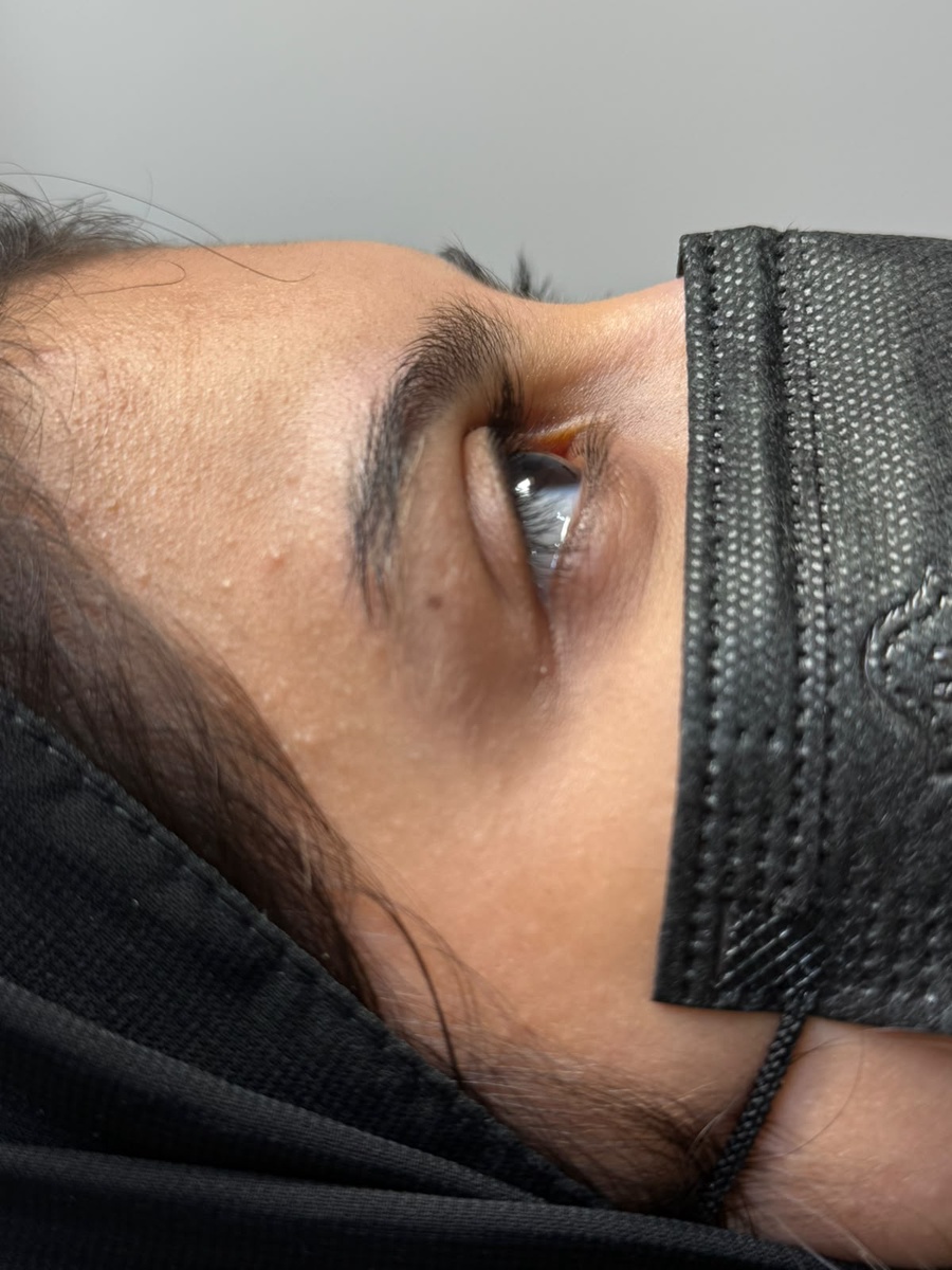 لامينيشن الحواجب (Brow Lamination)
