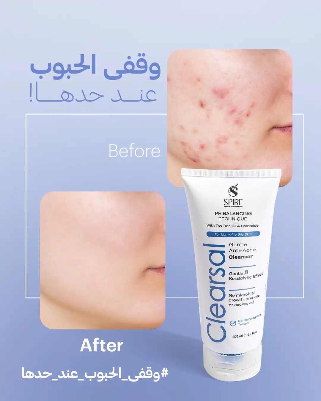 Clearsal Cleanser