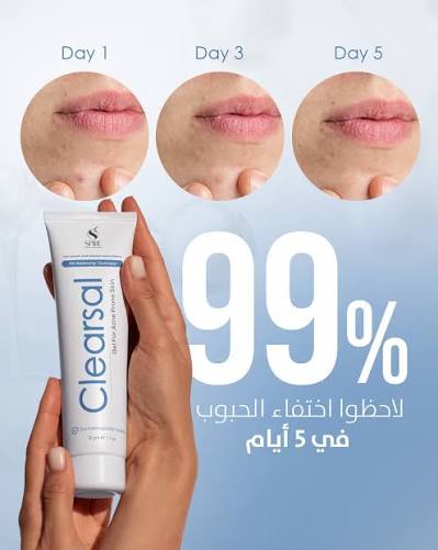 Clearsal Acne Gel