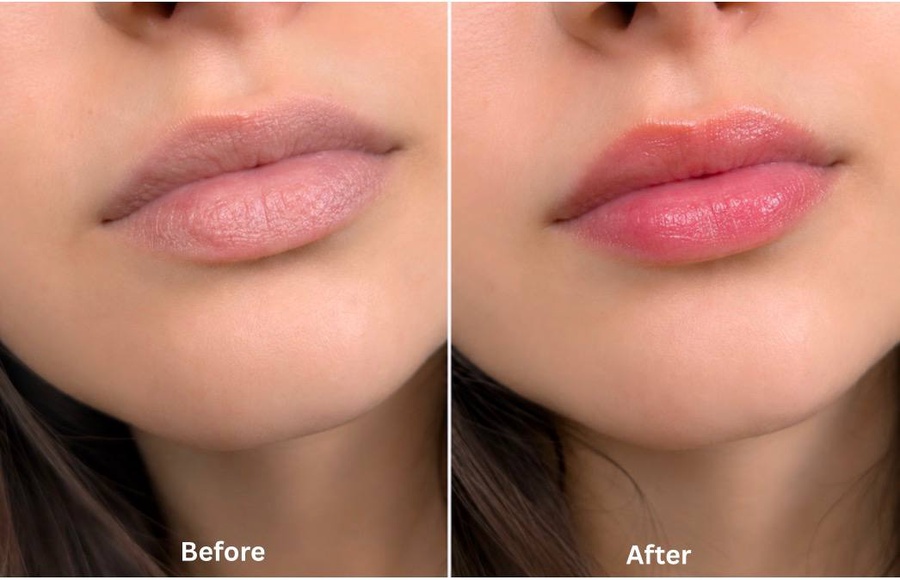 Lip Balm Locket | قلادة مرطب الشفاه