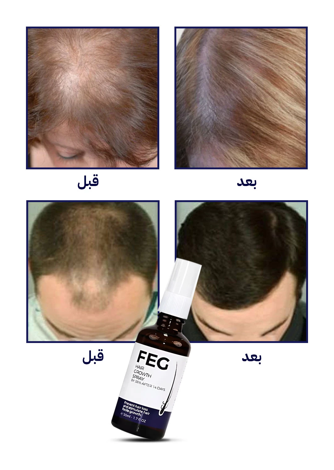 بخاخ FEG للعناية بالشعر وفروة الرأس 50 مل – FEG Hair Growth Spray