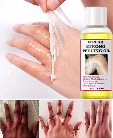 زيت التقشير الأصفر 110 مل للعناية بالبشرة – Extra Strong Peeling Oil