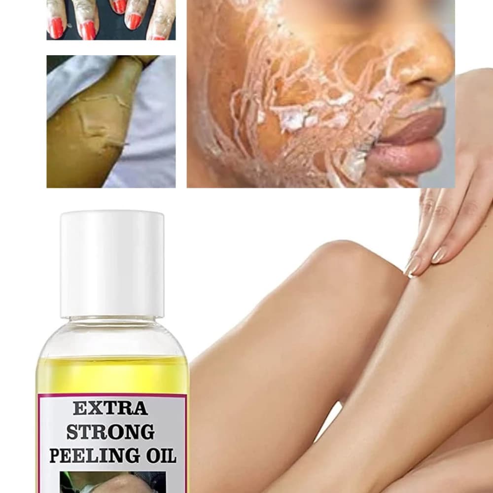 زيت التقشير الأصفر 110 مل للعناية بالبشرة – Extra Strong Peeling Oil