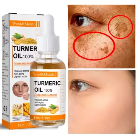 زيت الكركم للوجه 10 مل للعناية بالبشرة – Turmeric Oil 100% Pure and Natural
