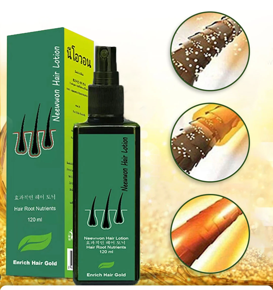 بخاخ نيو هير للعناية بالشعر وفروة الرأس 120 مل – New Hair Lotion Treatment