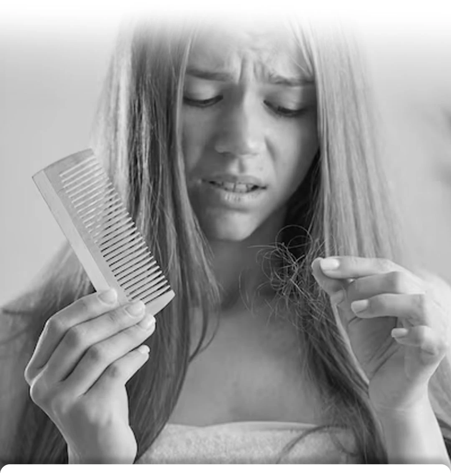 بخاخ نيو هير للعناية بالشعر وفروة الرأس 120 مل – New Hair Lotion Treatment