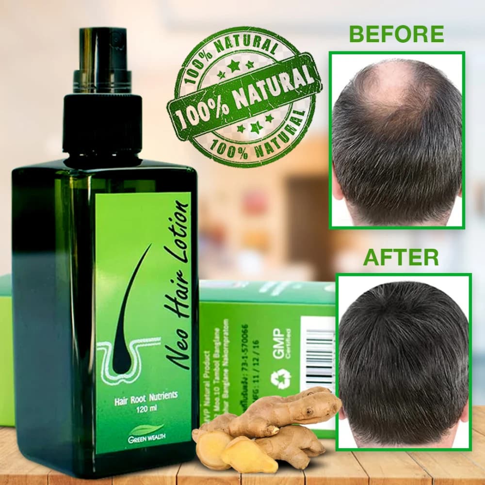 بخاخ نيو هير للعناية بالشعر وفروة الرأس 120 مل – New Hair Lotion Treatment