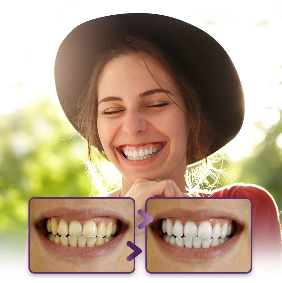 معجون تبييض الأسنان الأرجواني Advanced Purple Corrector Whitening Toothpaste