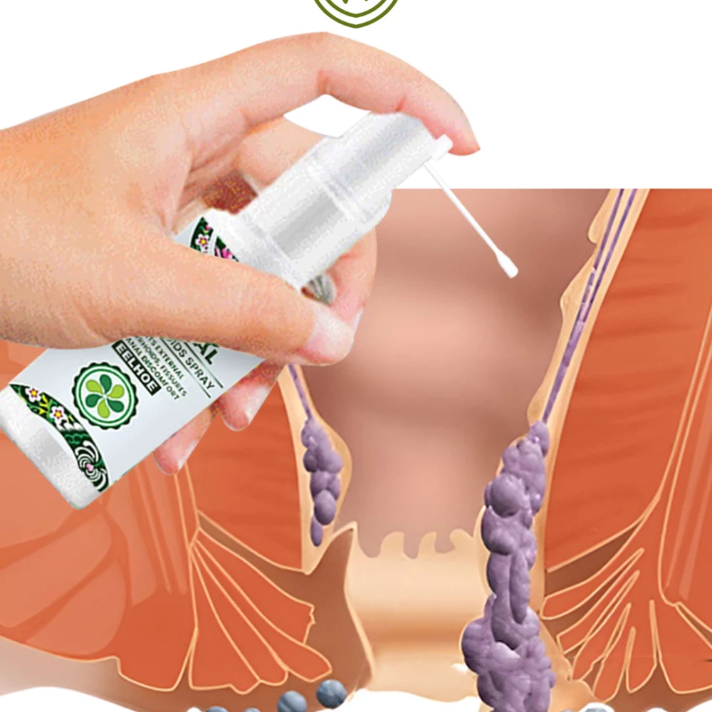 بخاخ عشبي طبيعي للعناية بمنطقة البواسير 30 مل – Natural Herbal Hemorrhoids Spray