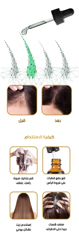 زيت إكليل الجبل العطري للشعر والحواجب والرموش 30 مل – Eelhoe Rosemary Essential Oil