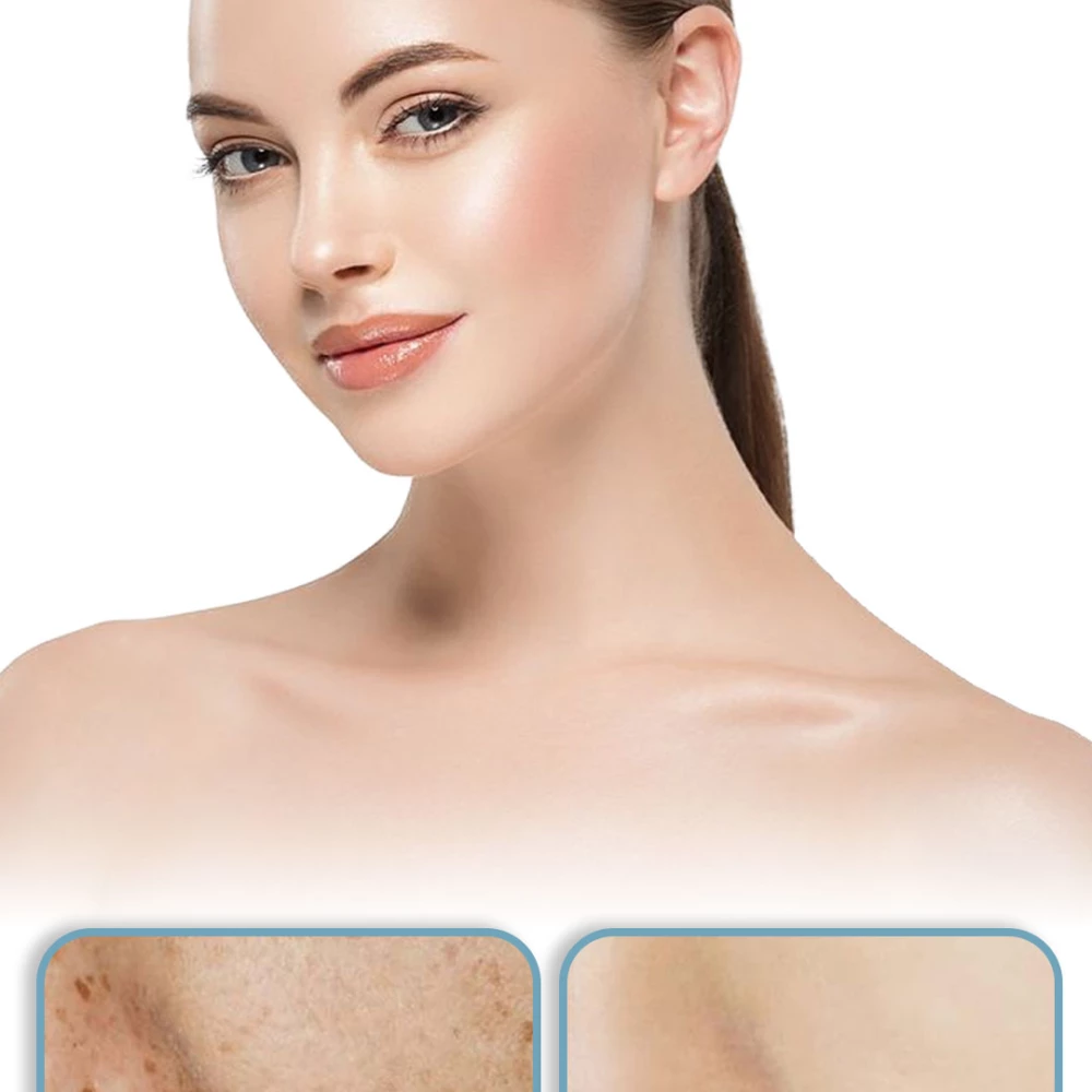 كريم للوجه لتفتيح وتوحيد مظهر البشرة والعناية بالبقع الداكنة – Whitening Face Cream Dark Spot Corrector