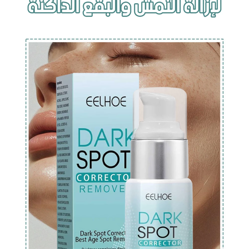 كريم للوجه لتفتيح وتوحيد مظهر البشرة والعناية بالبقع الداكنة – Whitening Face Cream Dark Spot Corrector
