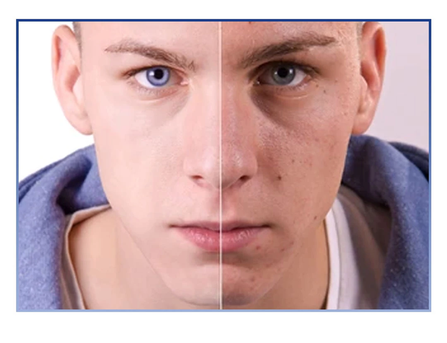 مصل البوتوكس المضاد للتجاعيد وشد بشرة الوجه - Botox Stock Solution Anti Ageing Serum, Botox Cream for Face