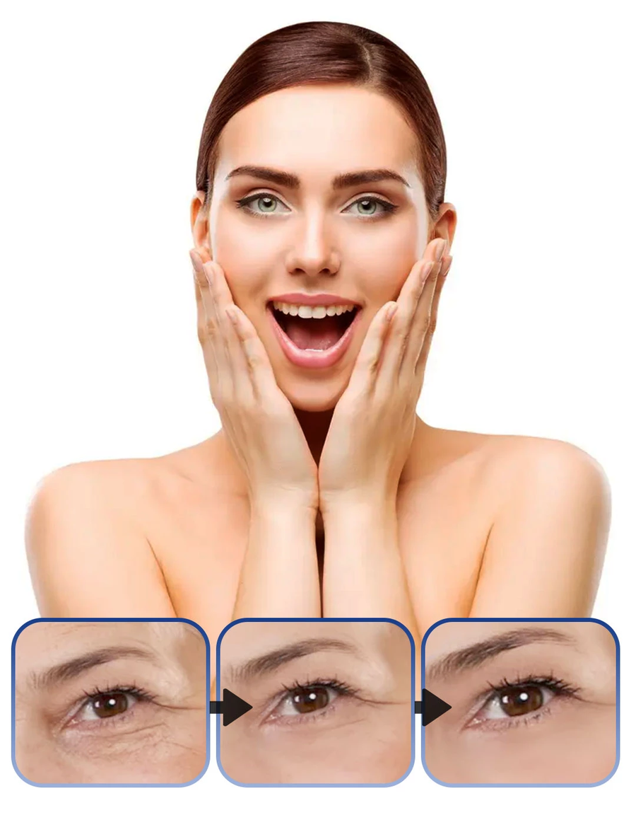 مصل البوتوكس المضاد للتجاعيد وشد بشرة الوجه - Botox Stock Solution Anti Ageing Serum, Botox Cream for Face