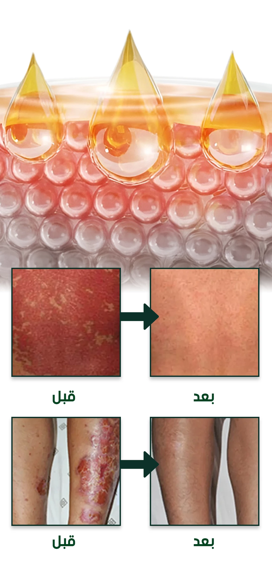 Skin Tinea Care External Cream - كريم عشبي للعناية بالبشرة