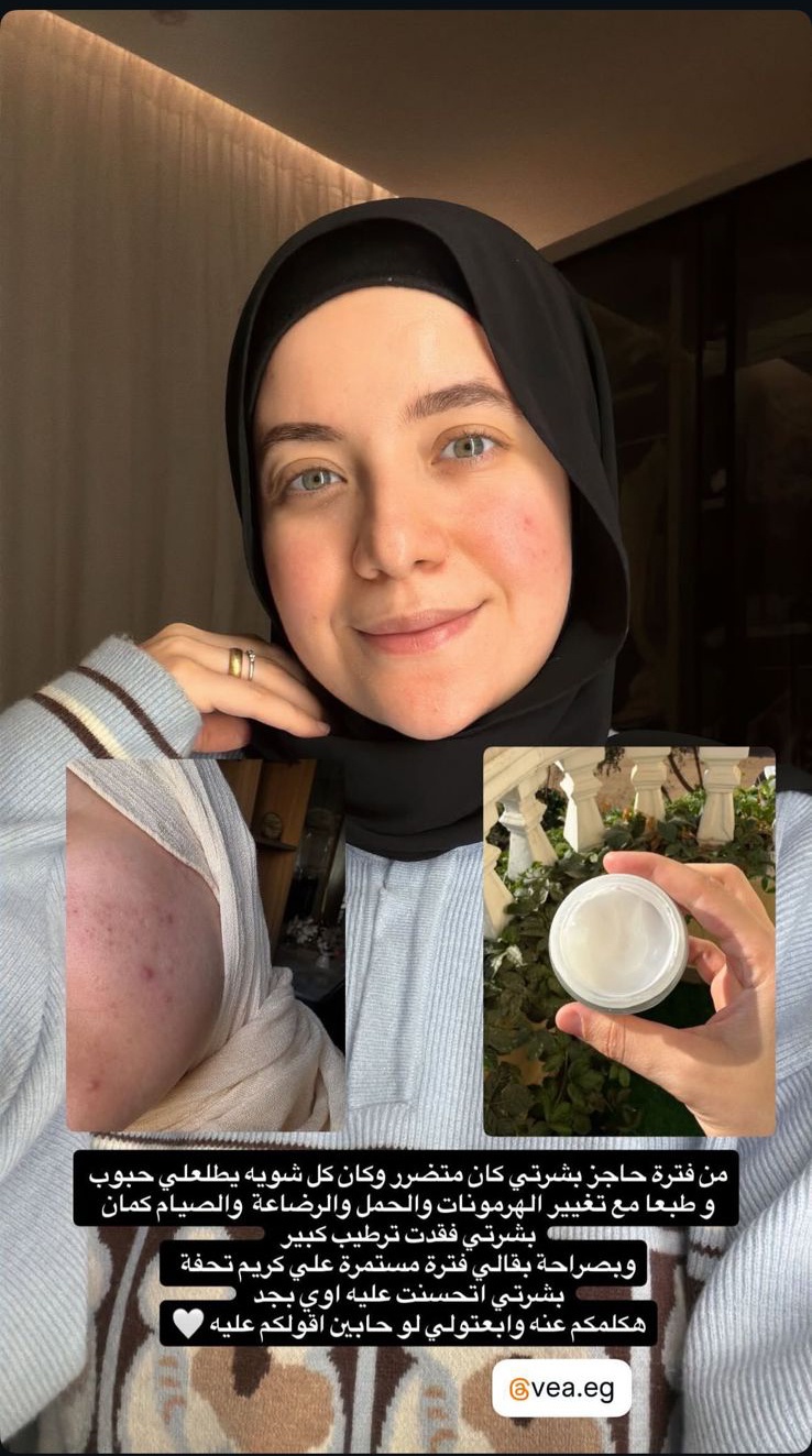 تجربة جهاد المحلاوي مع كريم Véa Matcha بعد أسبوع من الاستخدام