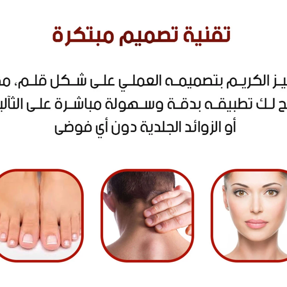 قلم إزالة الثآليل والزوائد الجلدية Skin Tag Remover and Wart Removal Pen سعة 3 مل