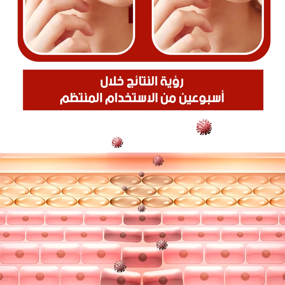 قلم إزالة الثآليل والزوائد الجلدية Skin Tag Remover and Wart Removal Pen سعة 3 مل
