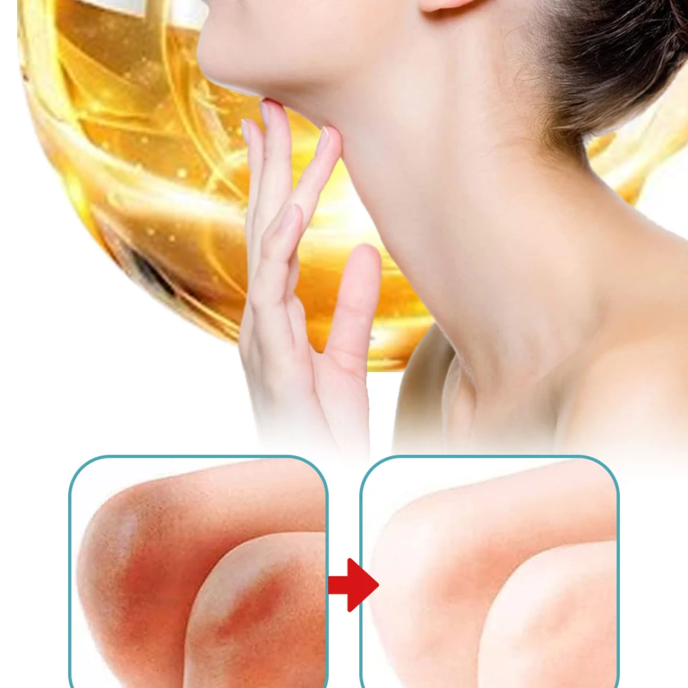 كريم إزالة الاسمرار والبقع الداكنة وتفتيح المناطق الداكنة Dark Spot Corrector Cream 50 جرام