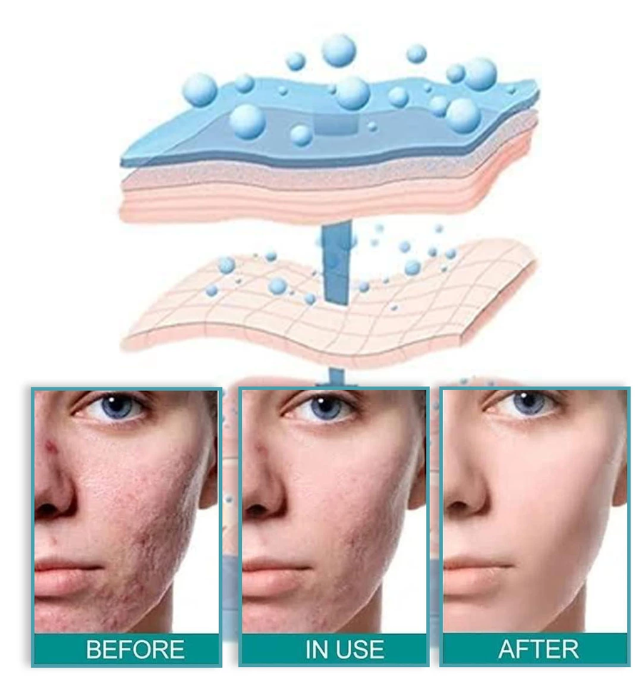 بخاخ مزيل الندبات Advanced Scar Removal Spray للعناية بمظهر الندبات والبقع الداكنة 20 جرام