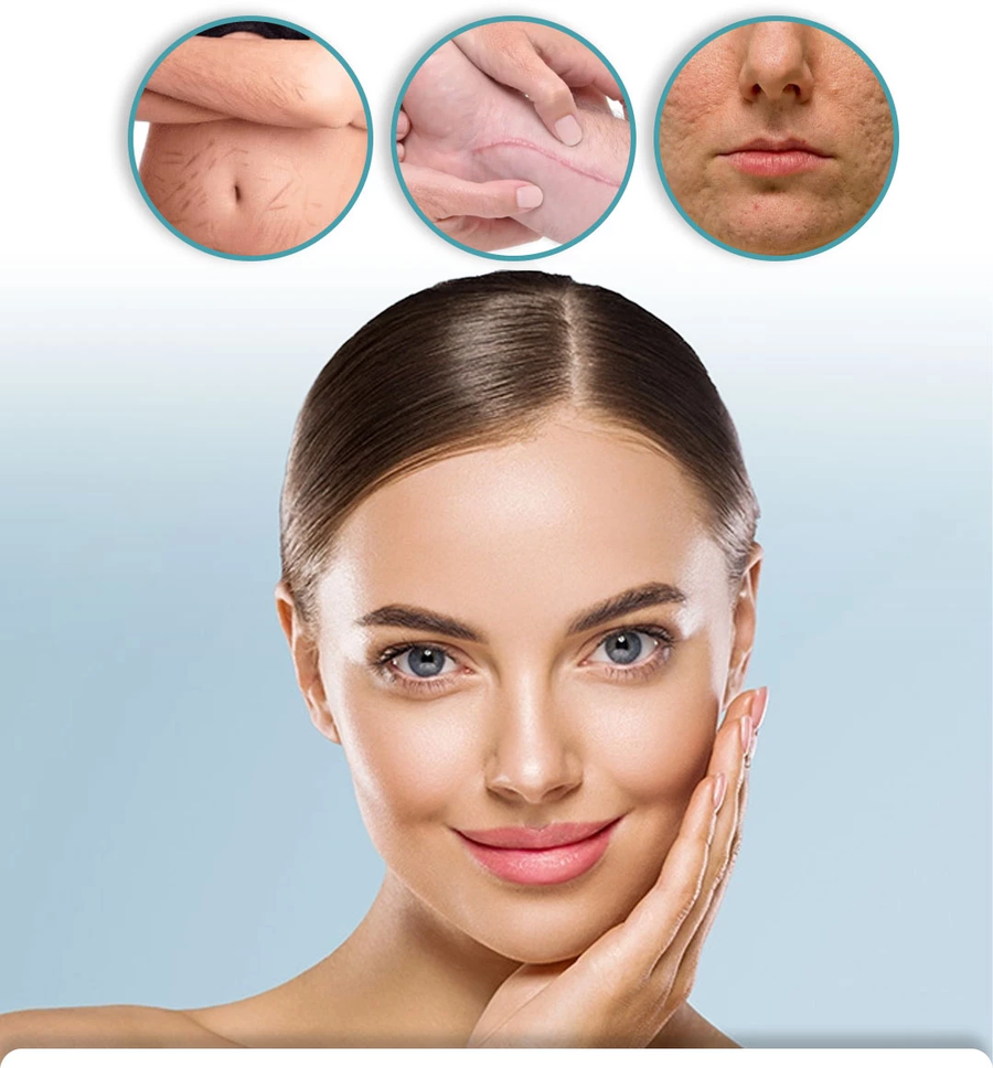 بخاخ مزيل الندبات Advanced Scar Removal Spray للعناية بمظهر الندبات والبقع الداكنة 20 جرام
