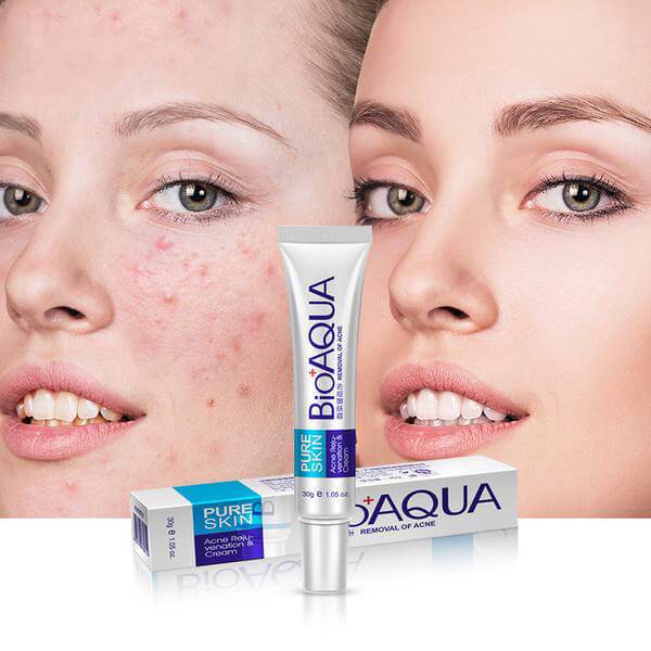 BIOAQUA - كريم إزالة حب الشباب وتجديد البشرة